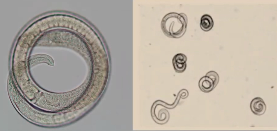 Trichinella spp video